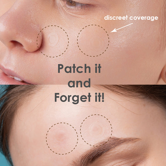 Magic Patch- Hydrocolloid Pimple Patch for Covering Zits / K- Beauty (Travel Size)